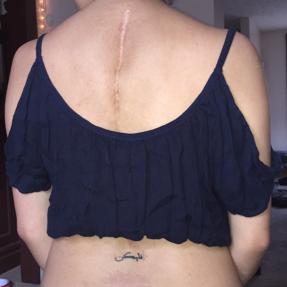 Navy Blue Hollister Lace Embroidered Crop Top M